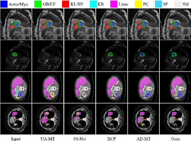Figure 3 for Style-Aware Blending and Prototype-Based Cross-Contrast Consistency for Semi-Supervised Medical Image Segmentation