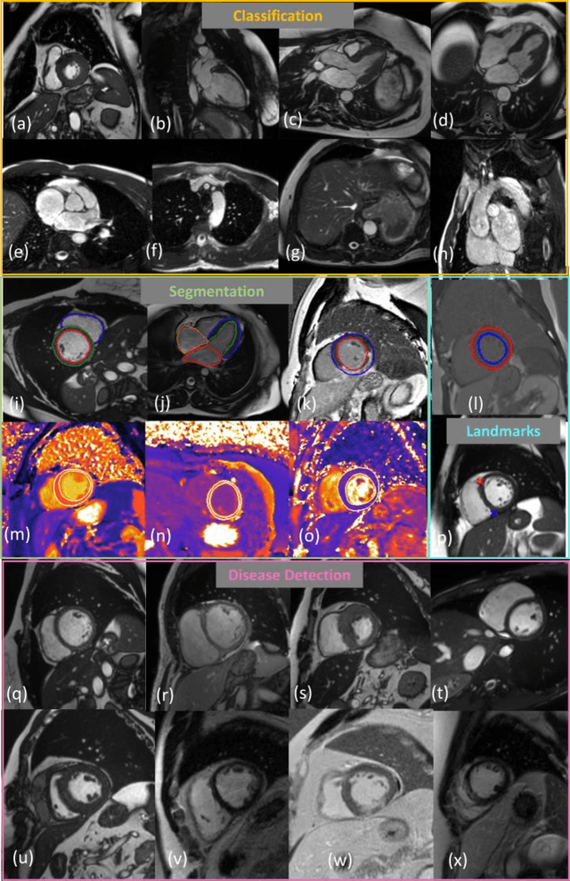 Figure 3 for Towards a vision foundation model for comprehensive assessment of Cardiac MRI