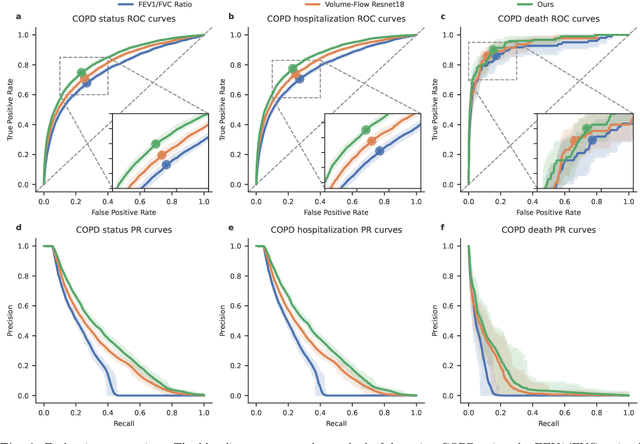 Figure 3 for Deep Learning for Detecting and Early Predicting Chronic Obstructive Pulmonary Disease from Spirogram Time Series: A UK Biobank Study