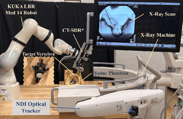 Figure 1 for S3D: A Spatial Steerable Surgical Drilling Framework for Robotic Spinal Fixation Procedures