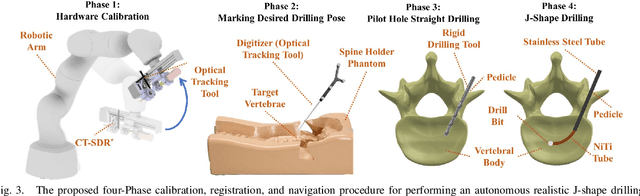 Figure 3 for S3D: A Spatial Steerable Surgical Drilling Framework for Robotic Spinal Fixation Procedures