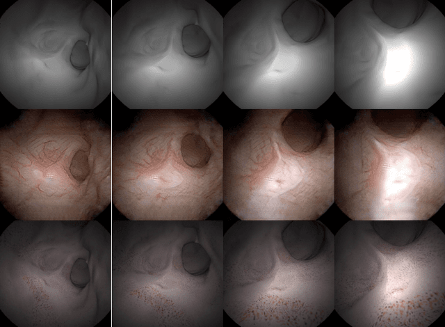 Figure 1 for MeshBrush: Painting the Anatomical Mesh with Neural Stylization for Endoscopy