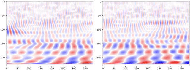 Figure 2 for An ADHD Diagnostic Interface Based on EEG Spectrograms and Deep Learning Techniques