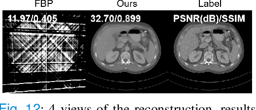 Figure 4 for Data-iterative Optimization Score Model for Stable Ultra-Sparse-View CT Reconstruction