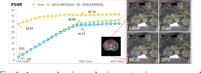 Figure 1 for Data-iterative Optimization Score Model for Stable Ultra-Sparse-View CT Reconstruction