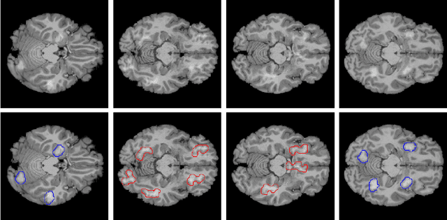 Figure 1 for Benchmark data to study the influence of pre-training on explanation performance in MR image classification