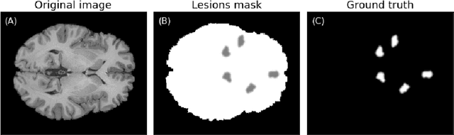 Figure 3 for Benchmark data to study the influence of pre-training on explanation performance in MR image classification