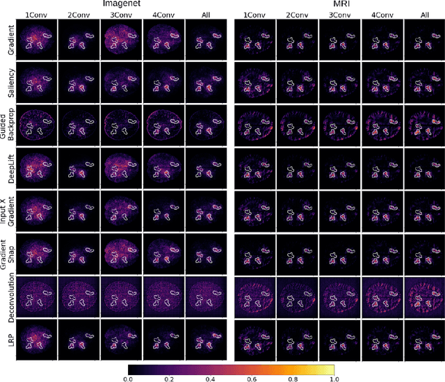 Figure 4 for Benchmark data to study the influence of pre-training on explanation performance in MR image classification