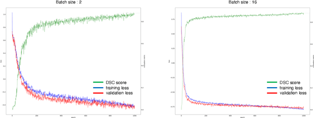 Figure 2 for Large Batch and Patch Size Training for Medical Image Segmentation