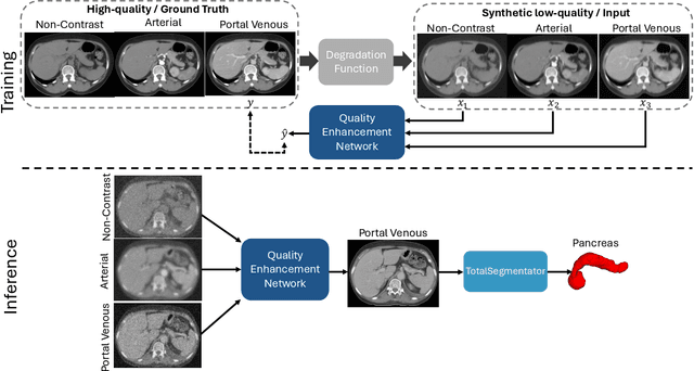 Figure 1 for Leveraging Multiphase CT for Quality Enhancement of Portal Venous CT: Utility for Pancreas Segmentation