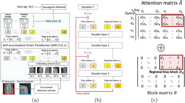 Figure 3 for Self-accumulative Vision Transformer for Bone Age Assessment Using the Sauvegrain Method