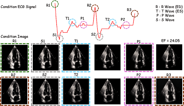 Figure 3 for ECHOPulse: ECG controlled echocardio-grams video generation