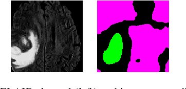 Figure 3 for A novel GAN-based paradigm for weakly supervised brain tumor segmentation of MR images