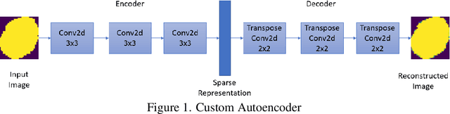 Figure 1 for AnoMalNet: Outlier Detection based Malaria Cell Image Classification Method Leveraging Deep Autoencoder