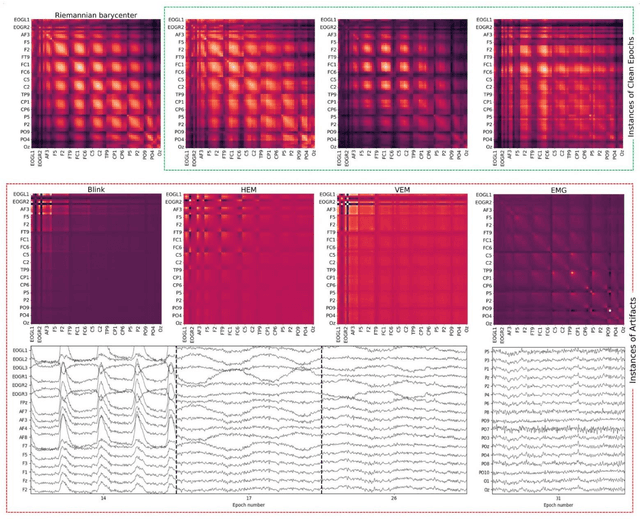 Figure 4 for Improved Riemannian potato field: an Automatic Artifact Rejection Method for EEG