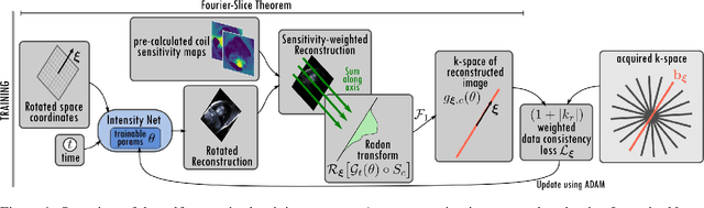 Figure 1 for Unsupervised reconstruction of accelerated cardiac cine MRI using Neural Fields