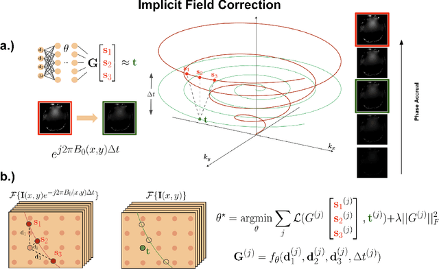 Figure 2 for Rapid Non-cartesian Reconstruction Using an Implicit Representation of GROG Kernels