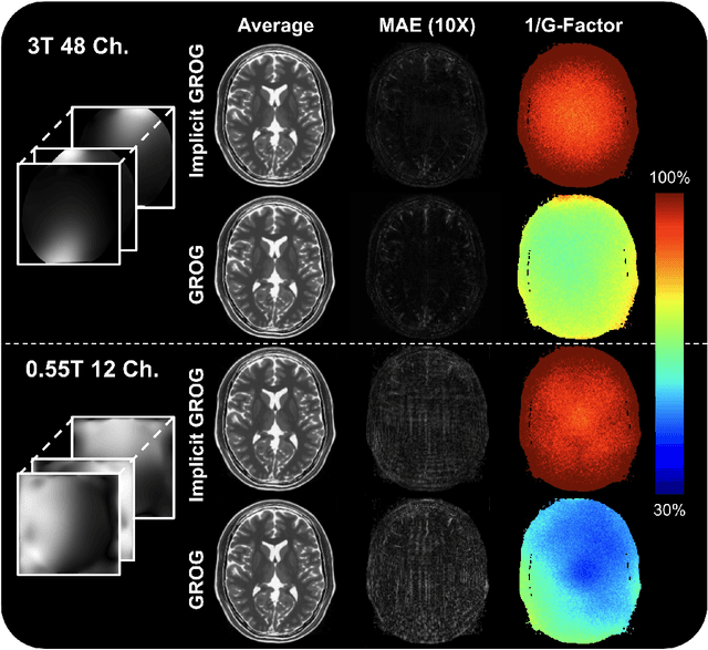 Figure 4 for Rapid Non-cartesian Reconstruction Using an Implicit Representation of GROG Kernels