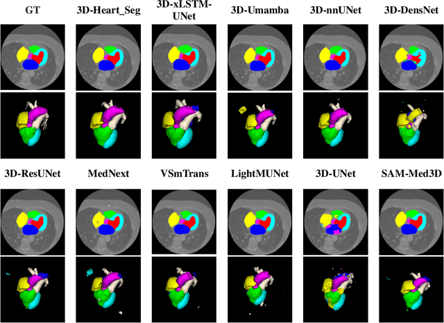 Figure 3 for Foundation Model for Whole-Heart Segmentation: Leveraging Student-Teacher Learning in Multi-Modal Medical Imaging