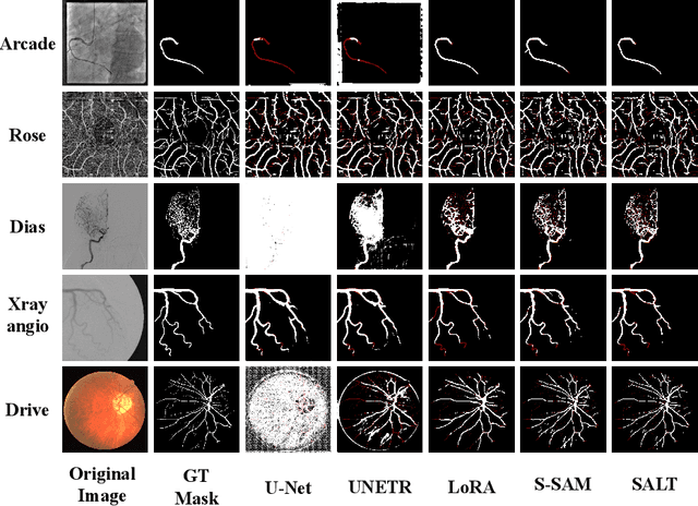 Figure 4 for SALT: Singular Value Adaptation with Low-Rank Transformation