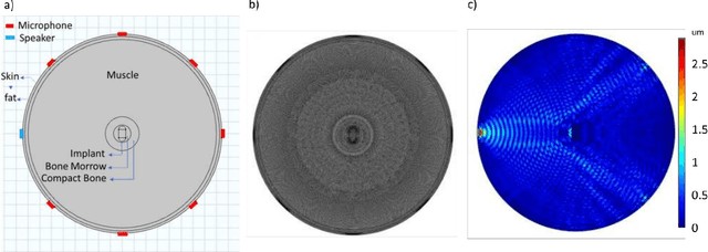 Figure 3 for A novel ultrasonic device for monitoring implant condition