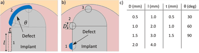 Figure 4 for A novel ultrasonic device for monitoring implant condition