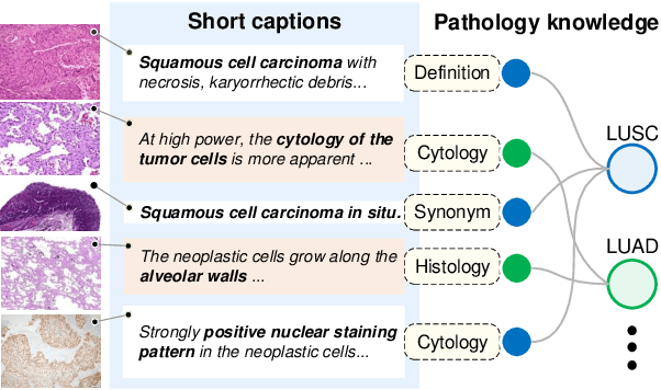 Figure 1 for Knowledge-enhanced Visual-Language Pretraining for Computational Pathology