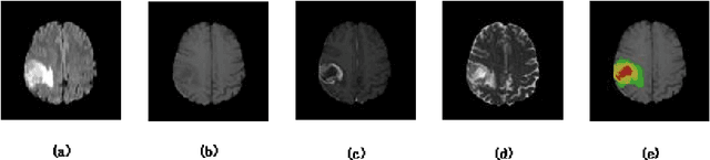 Figure 1 for MBDRes-U-Net: Multi-Scale Lightweight Brain Tumor Segmentation Network