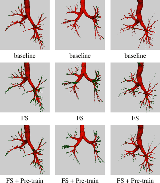 Figure 4 for Few-Shot Airway-Tree Modeling using Data-Driven Sparse Priors
