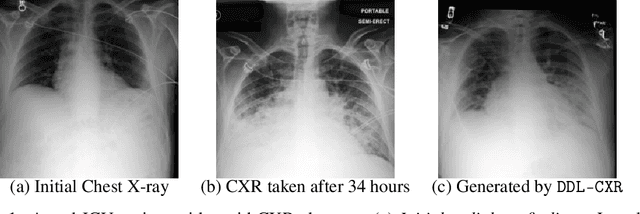 Figure 1 for Addressing Asynchronicity in Clinical Multimodal Fusion via Individualized Chest X-ray Generation