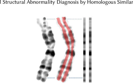 Figure 3 for Chromosomal Structural Abnormality Diagnosis by Homologous Similarity