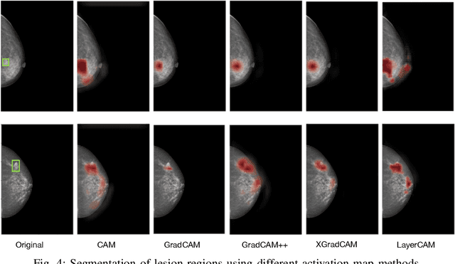 Figure 4 for Improving Mass Detection in Mammography Images: A Study of Weakly Supervised Learning and Class Activation Map Methods