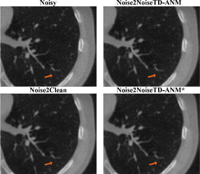 Figure 2 for Self-supervised Physics-based Denoising for Computed Tomography