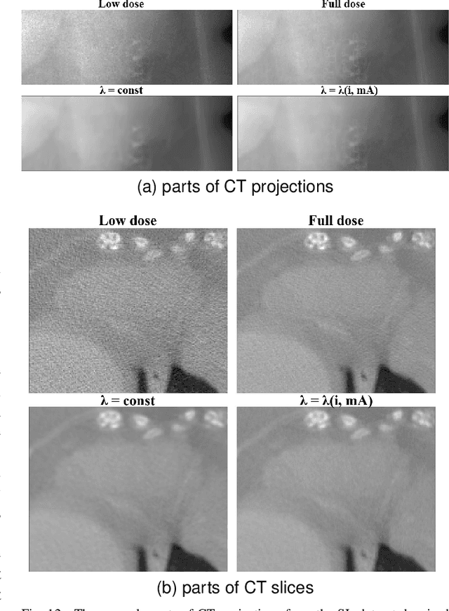 Figure 4 for Self-supervised Physics-based Denoising for Computed Tomography