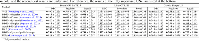 Figure 4 for Synomaly Noise and Multi-Stage Diffusion: A Novel Approach for Unsupervised Anomaly Detection in Ultrasound Imaging