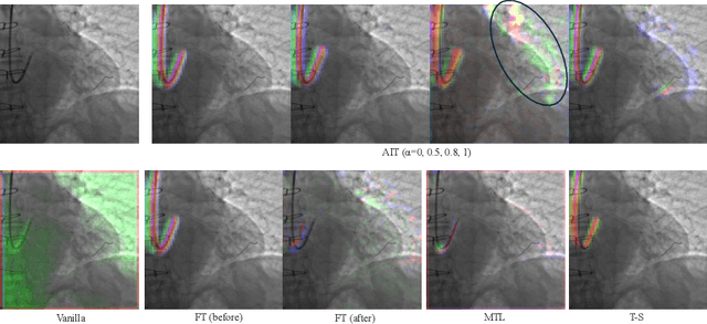 Figure 3 for Auxiliary Input in Training: Incorporating Catheter Features into Deep Learning Models for ECG-Free Dynamic Coronary Roadmapping