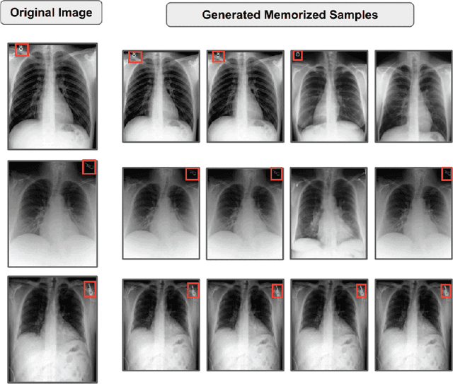 Figure 1 for MemControl: Mitigating Memorization in Medical Diffusion Models via Automated Parameter Selection