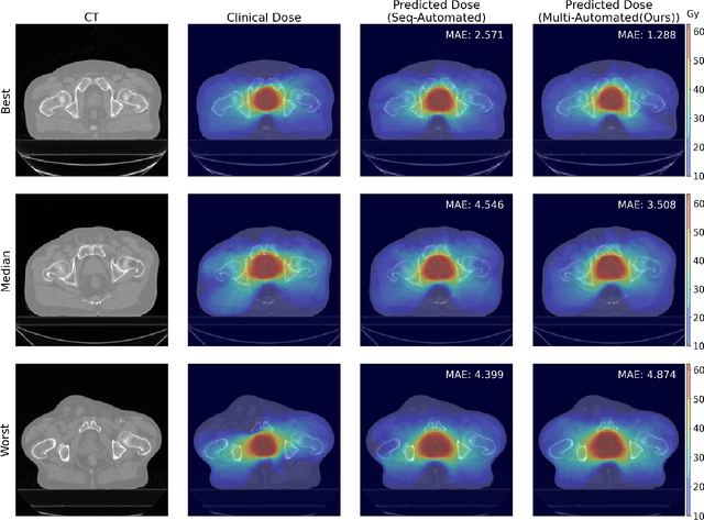 Figure 4 for Multi-Task Learning for Integrated Automated Contouring and Voxel-Based Dose Prediction in Radiotherapy