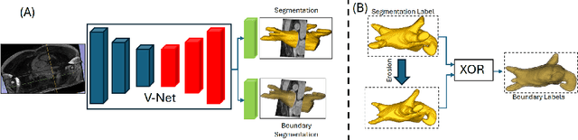 Figure 1 for BoundarySeg:An Embarrassingly Simple Method To Boost Medical Image Segmentation Performance for Low Data Regimes