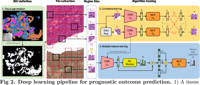 Figure 3 for Self-Contrastive Weakly Supervised Learning Framework for Prognostic Prediction Using Whole Slide Images