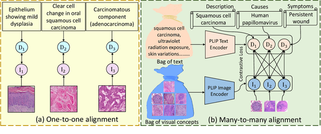 Figure 3 for CPLIP: Zero-Shot Learning for Histopathology with Comprehensive Vision-Language Alignment