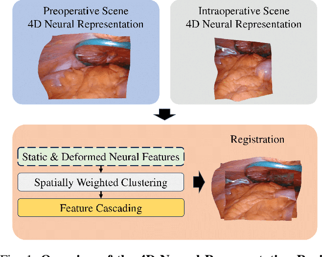 Figure 1 for Registering Neural 4D Gaussians for Endoscopic Surgery