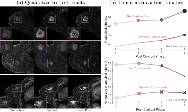 Figure 4 for Towards Learning Contrast Kinetics with Multi-Condition Latent Diffusion Models