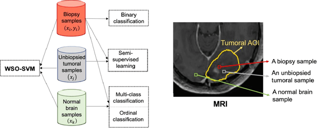 Figure 1 for Quantifying intra-tumoral genetic heterogeneity of glioblastoma toward precision medicine using MRI and a data-inclusive machine learning algorithm