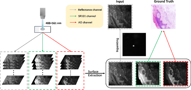 Figure 1 for Single color virtual H&E staining with In-and-Out Net