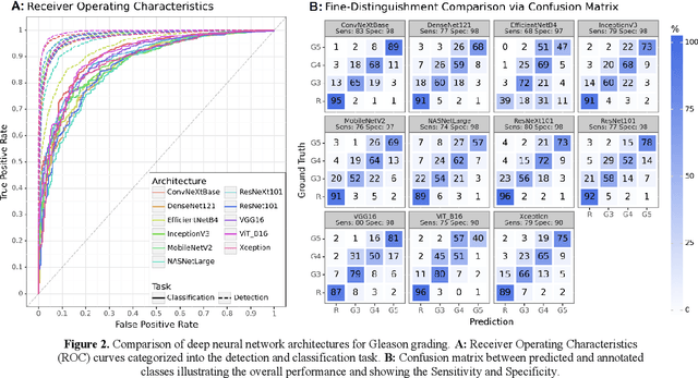 Figure 2 for Assessing the Performance of Deep Learning for Automated Gleason Grading in Prostate Cancer