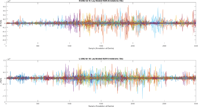 Figure 1 for Automated Movement Detection with Dirichlet Process Mixture Models and Electromyography