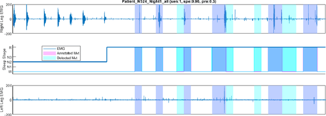 Figure 3 for Automated Movement Detection with Dirichlet Process Mixture Models and Electromyography