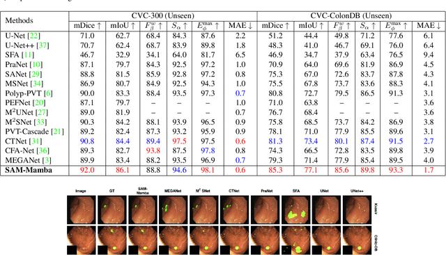 Figure 3 for SAM-Mamba: Mamba Guided SAM Architecture for Generalized Zero-Shot Polyp Segmentation