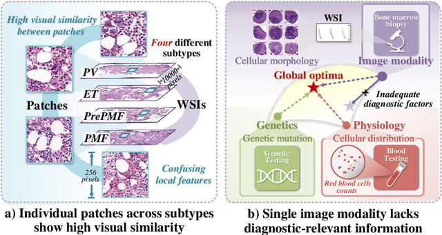 Figure 1 for DSCENet: Dynamic Screening and Clinical-Enhanced Multimodal Fusion for MPNs Subtype Classification